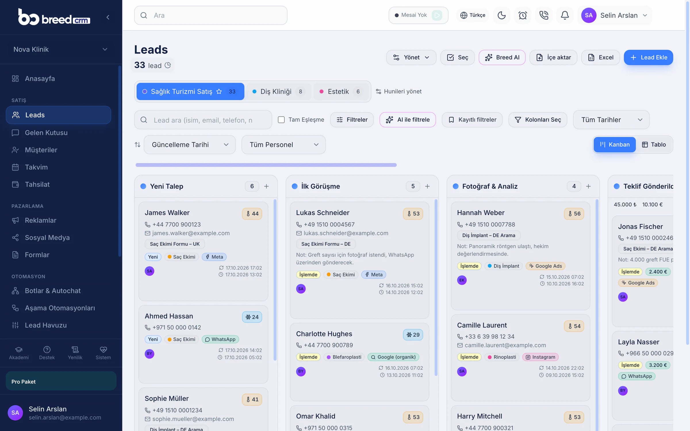 Lead-Board von Breed CRM: Leads in den Phasen der Vertriebspipeline mit KI-Score und Quelle